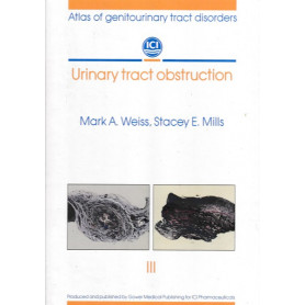 Urinary tract obstructionLibrisaggi