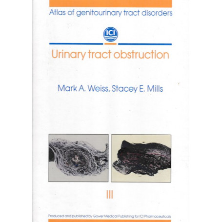 Urinary tract obstruction