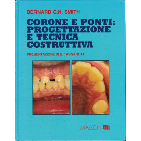 Corone e ponti: progettazione e tecnica costruttiva