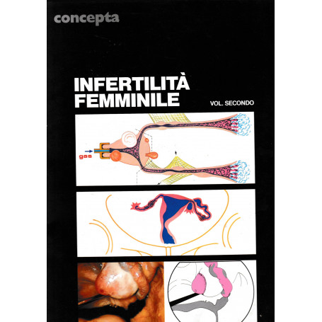 Infertilità femminile  volume 2° (un volume)