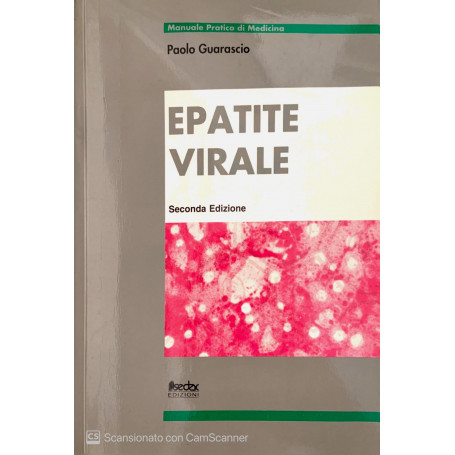 Epatite virale