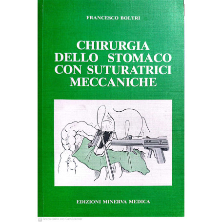 Chirurgia dello stomaco con suturartici meccaniche