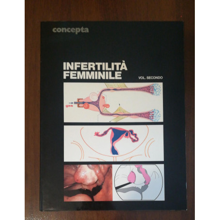 infertilità femminile vol 2