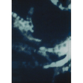 MicobatteriosiLibrisaggi