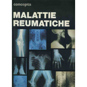 Malattie reumatiche